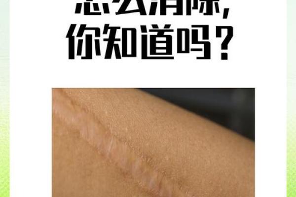 探讨鼻子上出现横纹的原因及可能影响